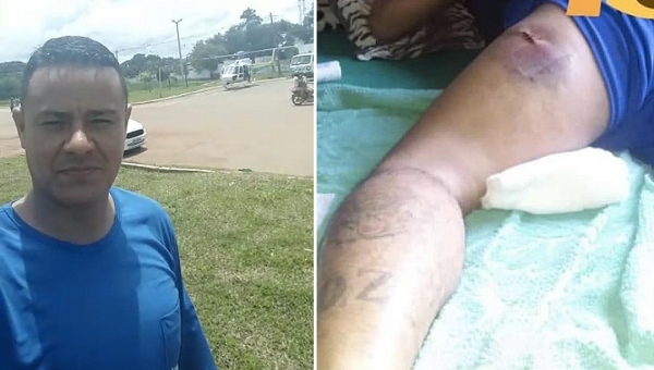 Homem filmava momento em que caminhão bateu em helicóptero do Estado e foi ferido por estilhaço