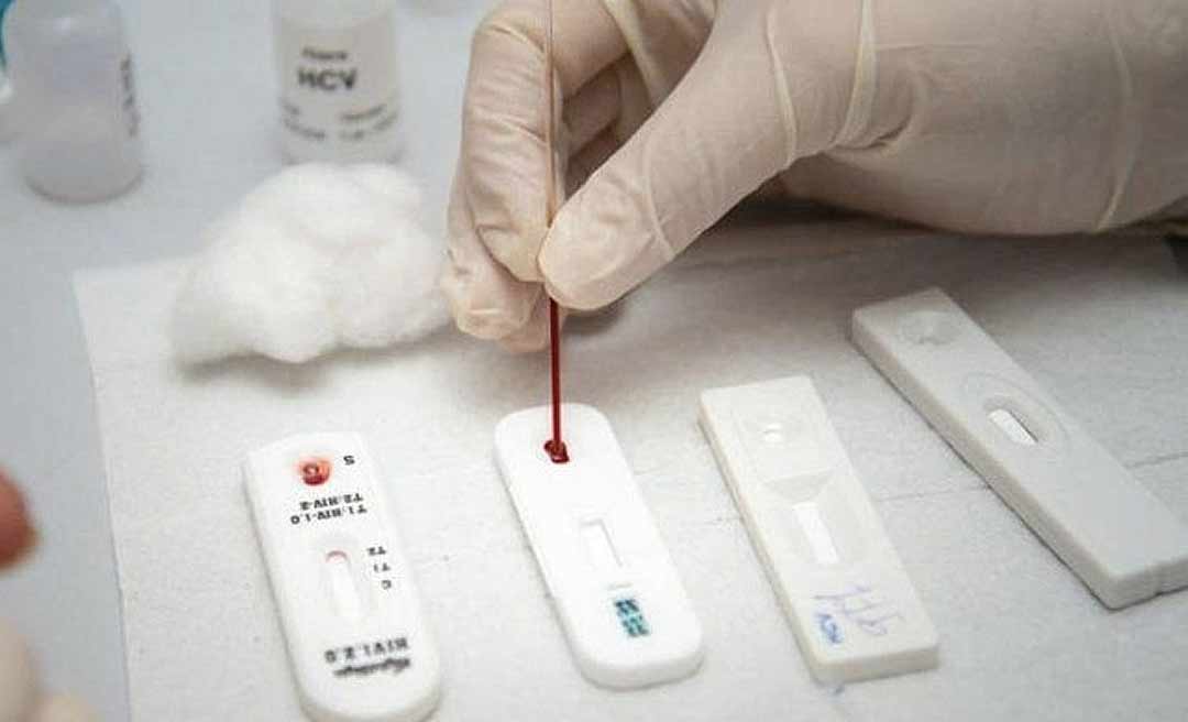 Prefeitura de Brasiléia compra 3 mil testes rápidos para detectar Covid-19 