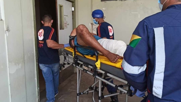 Trabalhador rural corre o risco de perder a perna após disparo acidental durante caçada