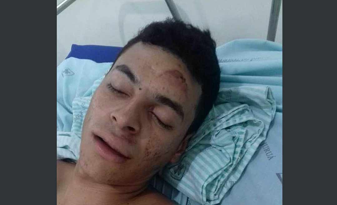 Após denúncia da família nas redes, Sesacre faz transferência de jovem vítima de acidente de trânsito