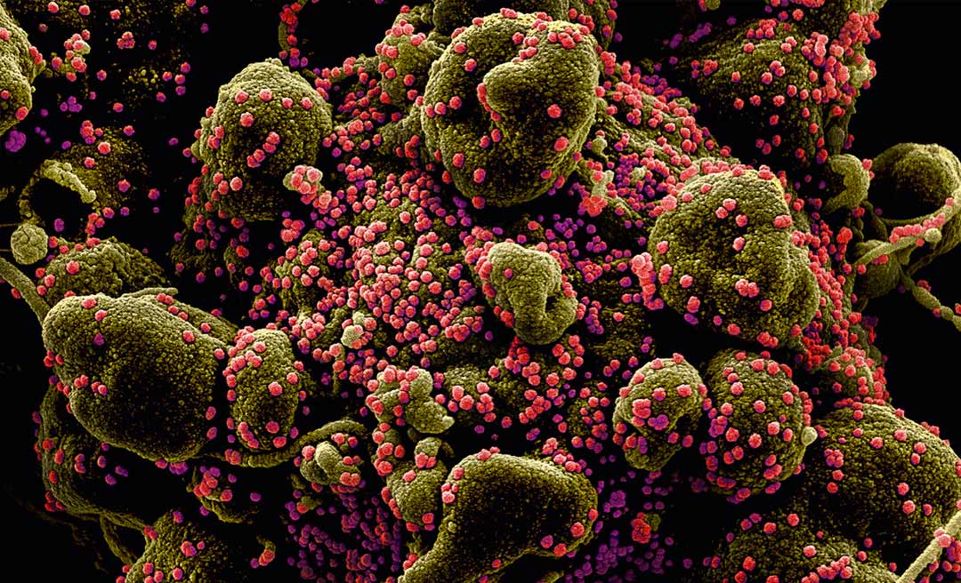 Mutação do coronavírus detectada no Reino Unido 'certamente já circula no Brasil', diz sanitarista