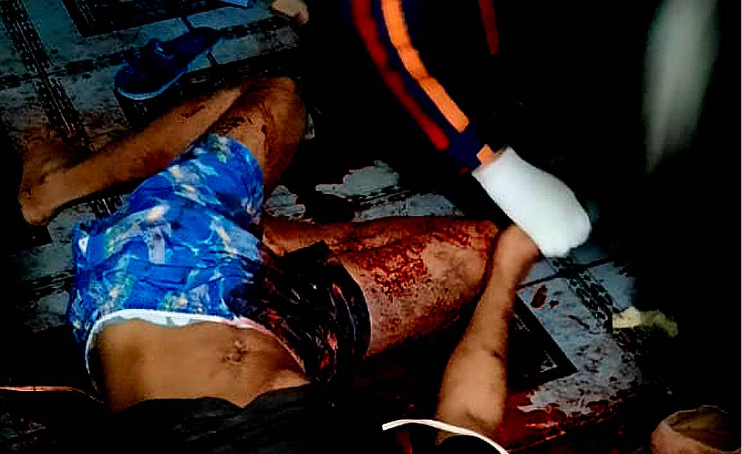 Criminosos invadem casa na Vila do Incra e atiram 8 vezes, dois disparos são na cabeça da vítima