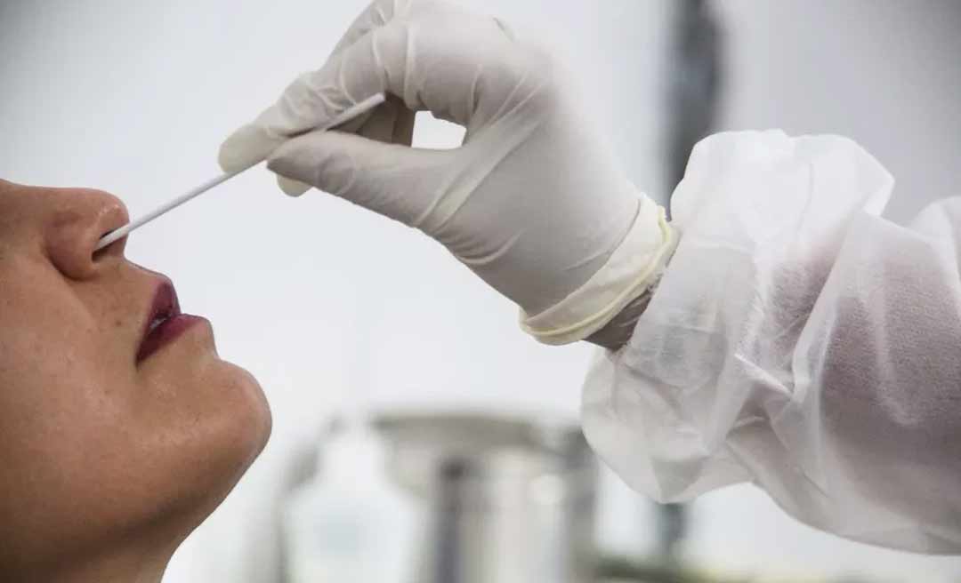 Acre registrou 199 casos de infecção e três mortes por covid-19 nesta quarta-feira