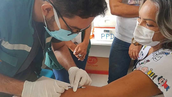 Equipe de saúde de Rio Branco recebe treinamento teórico e prático em Prova Tuberculínica