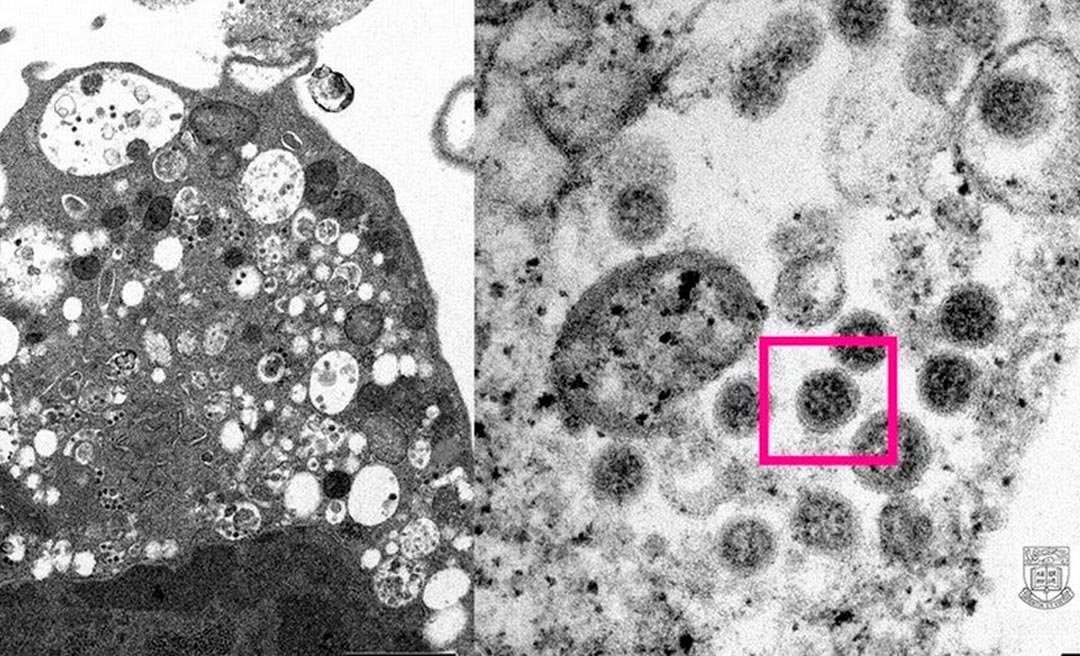 Ômicron: dados mostram que casos tendem a diminuir em dois meses