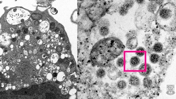 Ômicron: dados mostram que casos tendem a diminuir em dois meses