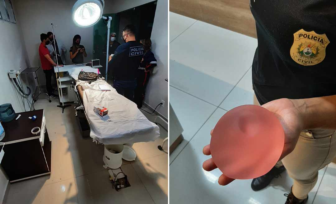 Imagens mostram momento em que médico sem CRM é flagrado colocando silicone em mulher