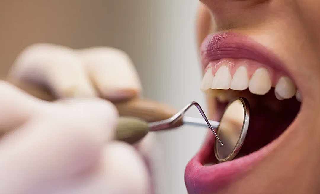 Cientistas vão testar medicamento inédito que faz dentes crescerem novamente