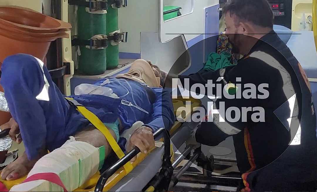 Pai e filha caem de moto no Ramal Palhal após colisão com carro e ficam e estado grave