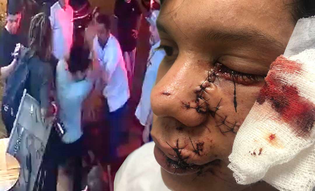 Familiares e amigos de jovem agredido por empresário em Brasileia clamam por justiça e fazem manifestação