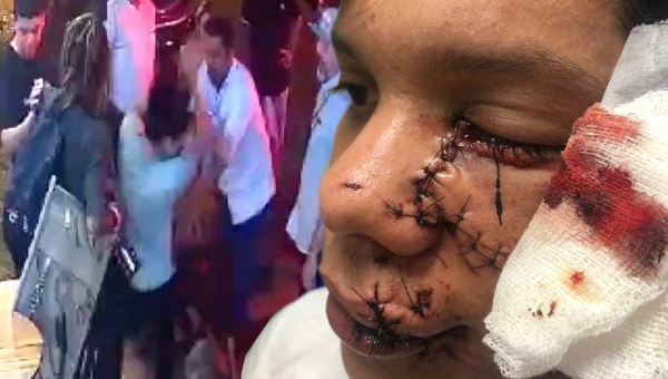 Familiares e amigos de jovem agredido por empresário em Brasileia clamam por justiça e fazem manifestação