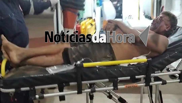 Para não morrer, homem busca ‘salvação’ em igreja após ser violentamente espancado por bandidos