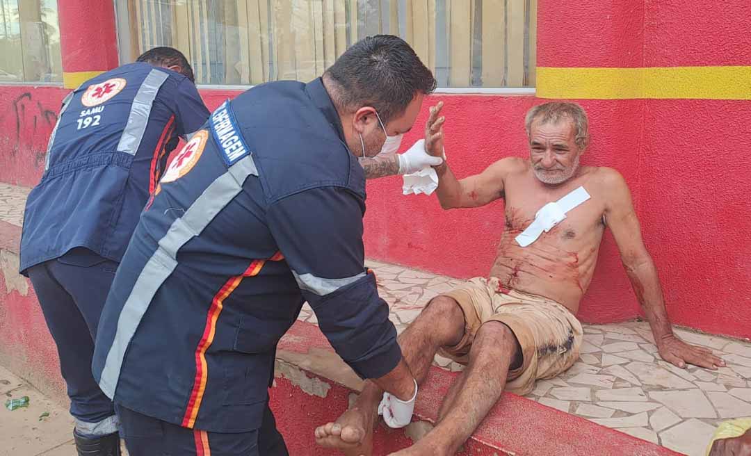 Homem é brutalmente ferido à golpes de garrafa no 2⁰ Distrito de Rio Branco