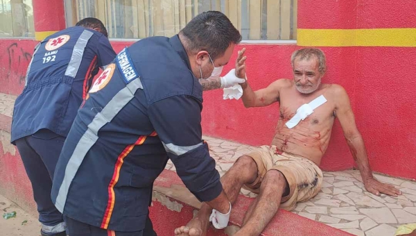 Homem é brutalmente ferido à golpes de garrafa no 2⁰ Distrito de Rio Branco