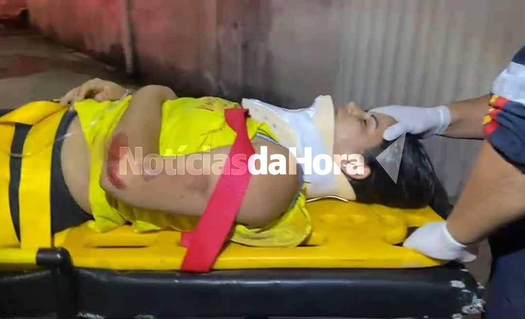 Capivara provoca acidente na estrada de Porto Acre e motociclista vai parar no Pronto-Socorro