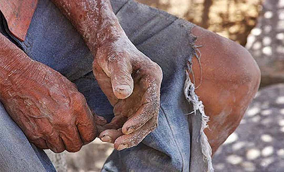 'Lista suja' do MT identifica dois empregadores do Acre que submeteram pessoas a trabalho escravo