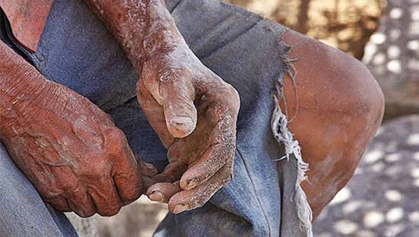 'Lista suja' do MT identifica dois empregadores do Acre que submeteram pessoas a trabalho escravo
