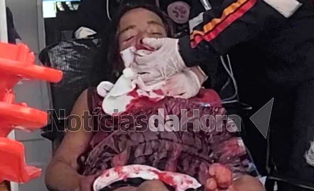 Mulher trans em situação de rua é esfaqueada no pescoço no bairro Papoco