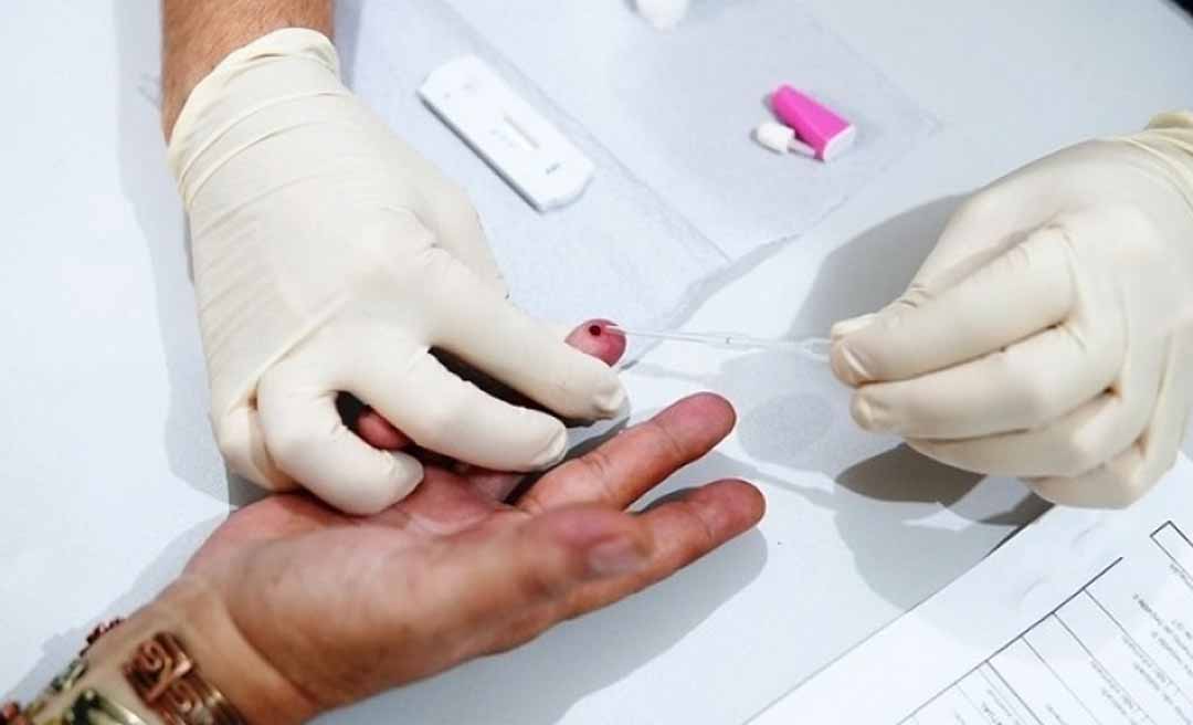 Quase cinco mil casos de hepatite confirmados no Acre desde 2015, alerta Sesacre