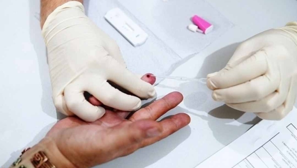 Quase cinco mil casos de hepatite confirmados no Acre desde 2015, alerta Sesacre