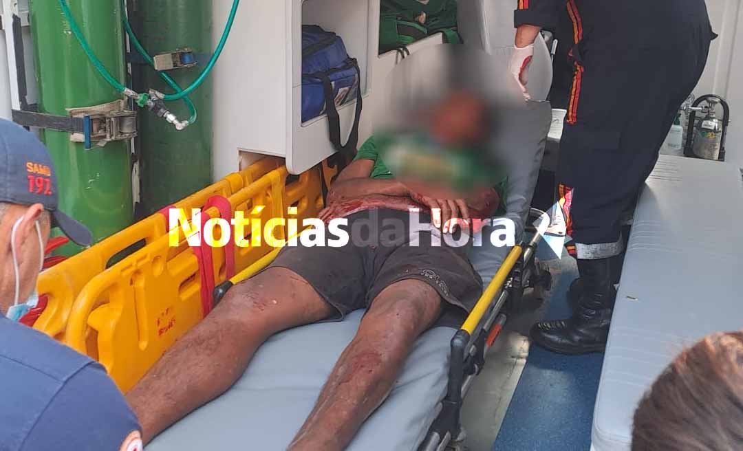 Briga entre moradores em situação de rua em Rio Branco termina com um homem ferido na cabeça