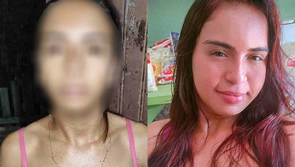 Mulher acusada de matar jovem de 22 anos a facadas é solta após realização de audiência de custódia