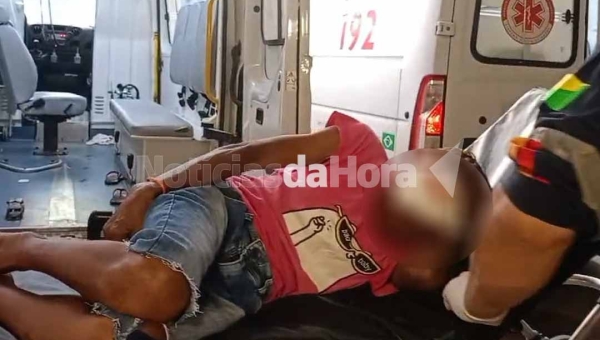 Idosa sofre traumatismo grave após atropelamento na Baixada do Sobral; vítima teve afundamento de crânio