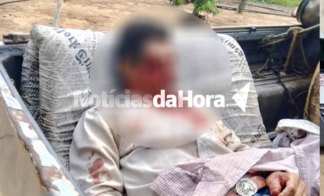 Colono sofre afundamento de crânio após colisão entre motos em Sena Madureira; vítima foi entubada