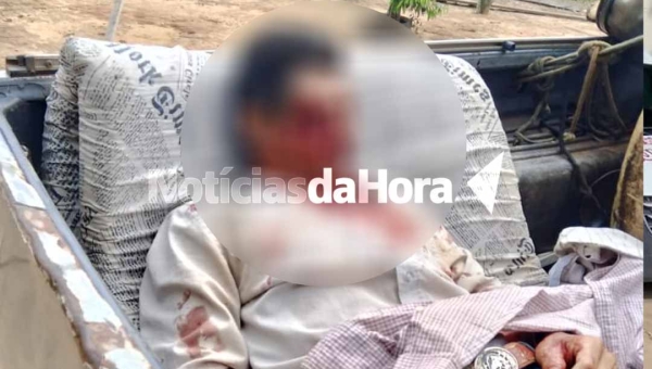 Colono sofre afundamento de crânio após colisão entre motos em Sena Madureira; vítima foi entubada