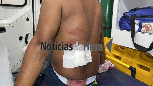 Homem é esfaqueado na Baixada da Sobral por cliente após informar que não tinha mais galinhas para vender em bar