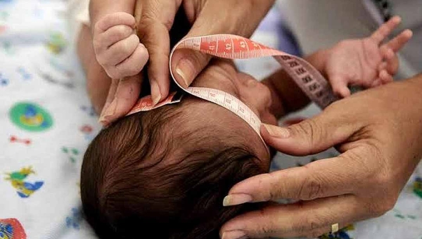 Governo Federal sanciona lei que garante indenização e pensão vitalícia a pessoas com deficiência permanente causada pela síndrome congênita do Zika vírus