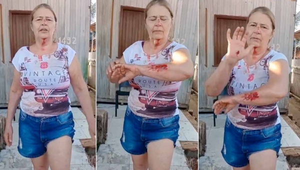 Moradora de Tarauacá sofre queda de moto e faz apelo por melhorias nas ruas do município