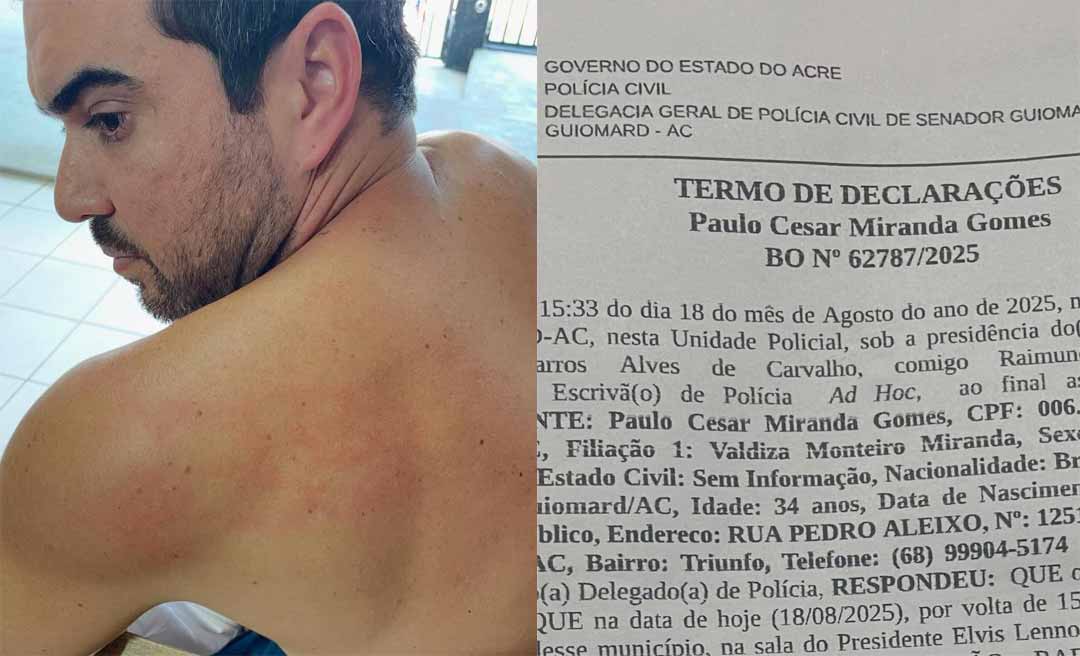 Vereador de Senador Guiomard registra B.O após denúncia de agressão dentro da Câmara por colega de parlamento