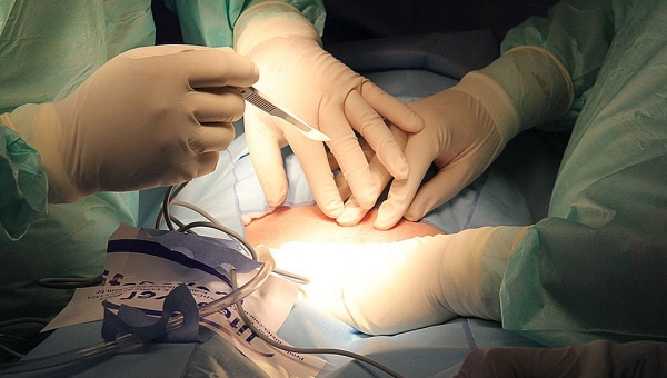 Justiça mantém condenação contra o governo do Acre por negligência em pós-operatório na Fundação