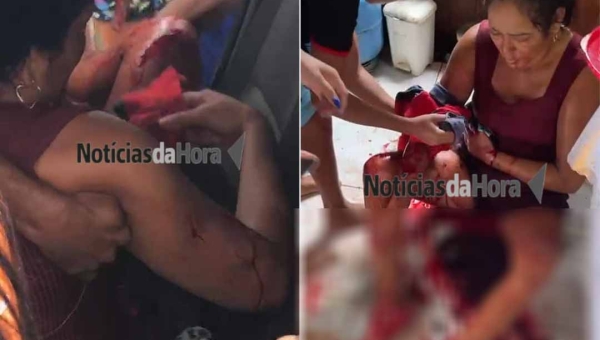 Mulher fica gravemente ferida após ser esfaqueada pelo menos 16 vezes pelo ex-companheiro em Sena Madureira