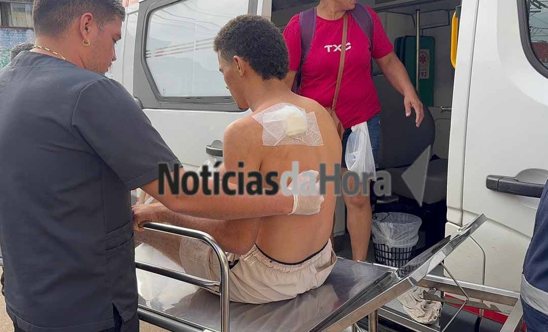Homem é baleado acidentalmente por amigo durante caçada na zona rural de Xapuri