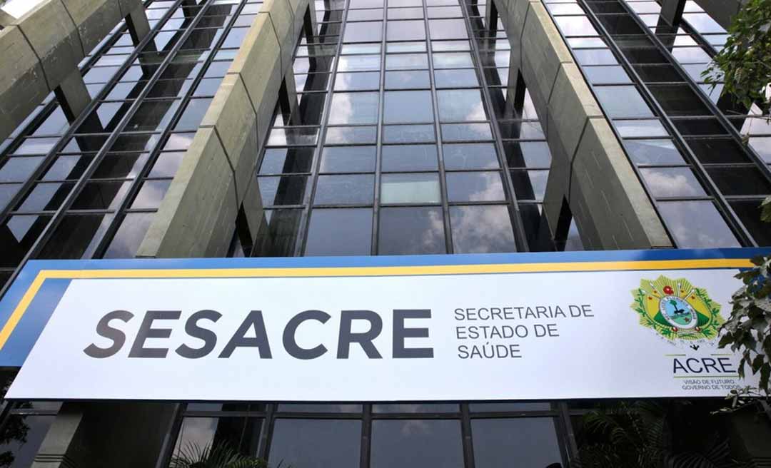 Sesacre firma contratos de quase R$ 3 milhões para luvas, guardanapos e até pilhas alcalinas