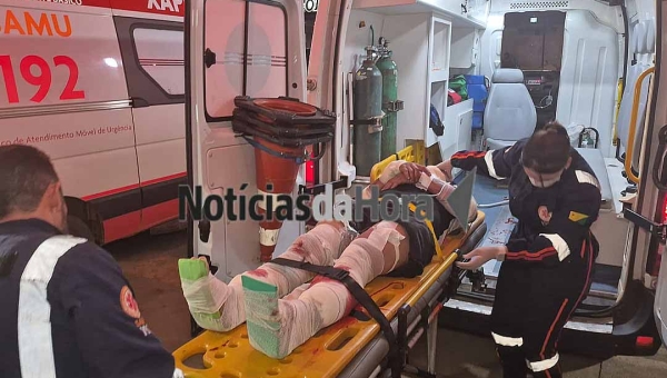 Motociclista sofre fraturas expostas após colisão com carro no Ramal do Herculano, zona rural da Capital